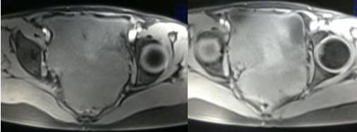 女性下腹疼痛是什么病,女性下腹疼痛的预兆