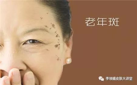 「杏林微科普」异斑异法早知道