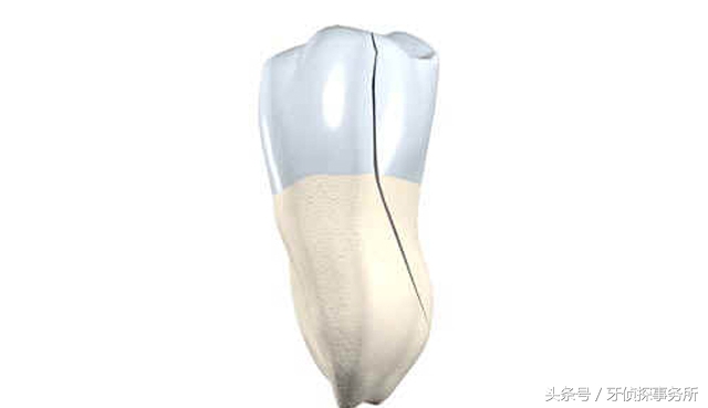 牙齿敏感抗敏牙膏有效吗,牙齿冷热酸甜都敏感用哪种牙膏