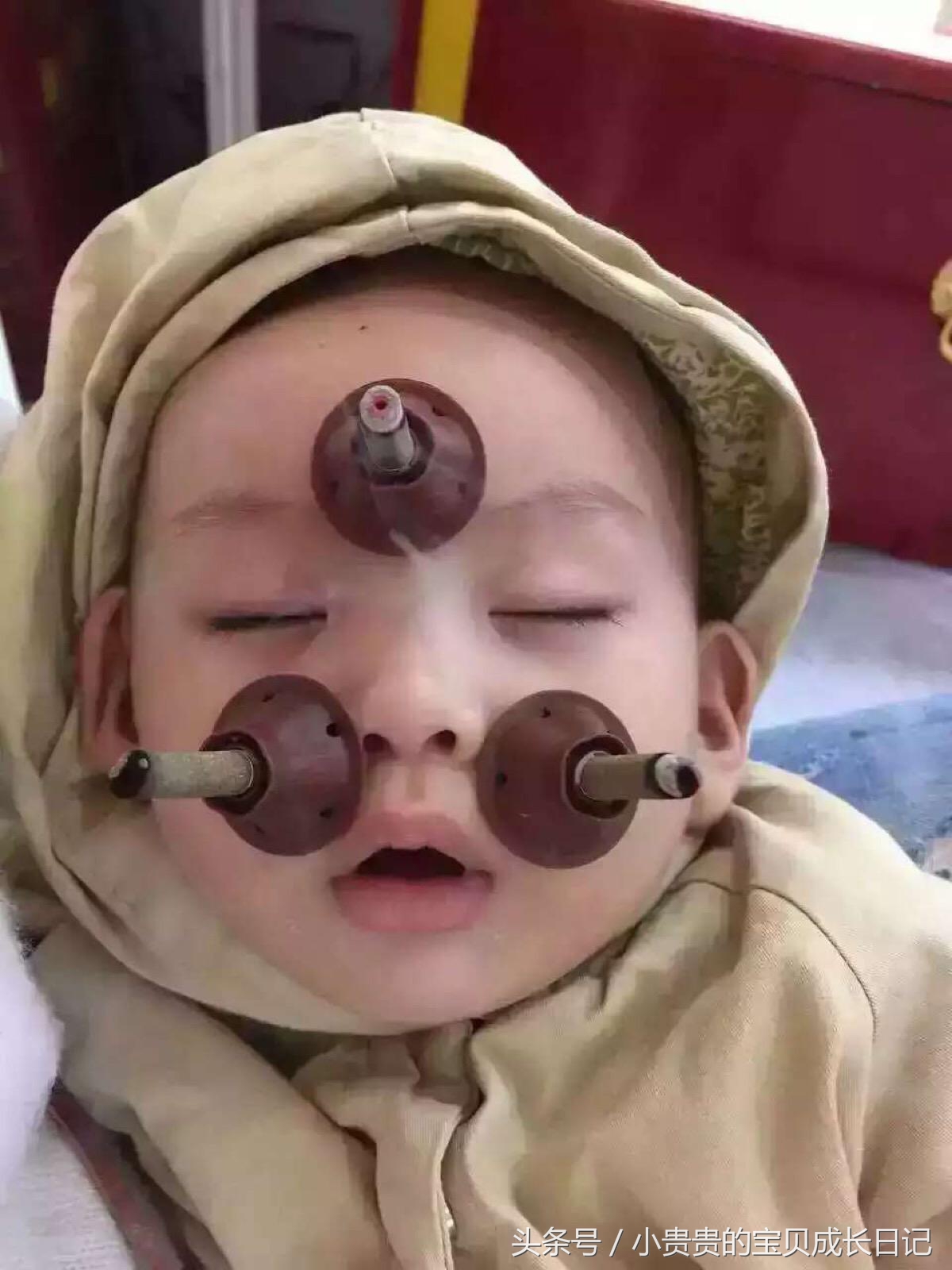 十岁孩子流鼻涕怎么办最简单方法,婴儿咳嗽流鼻涕怎么办最简单方法