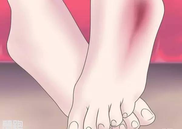 90%的跑友受伤后都用错了外敷药物