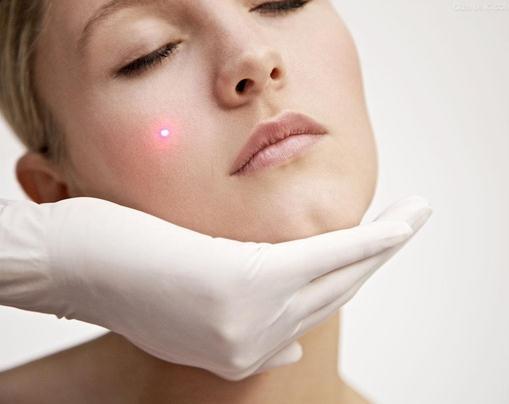 果酸换肤美白效果,果酸换肤和m22光子嫩肤哪个先做