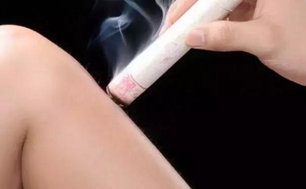 脾虚湿气重能不能用拔罐和艾灸治,艾灸治疗脾虚最好的方法