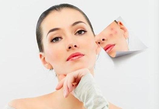 果酸换肤美白效果,果酸换肤和m22光子嫩肤哪个先做