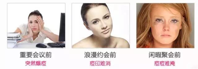 痘痘类皮肤的护理方法有哪些,痘痘肌肤的8个护理方式