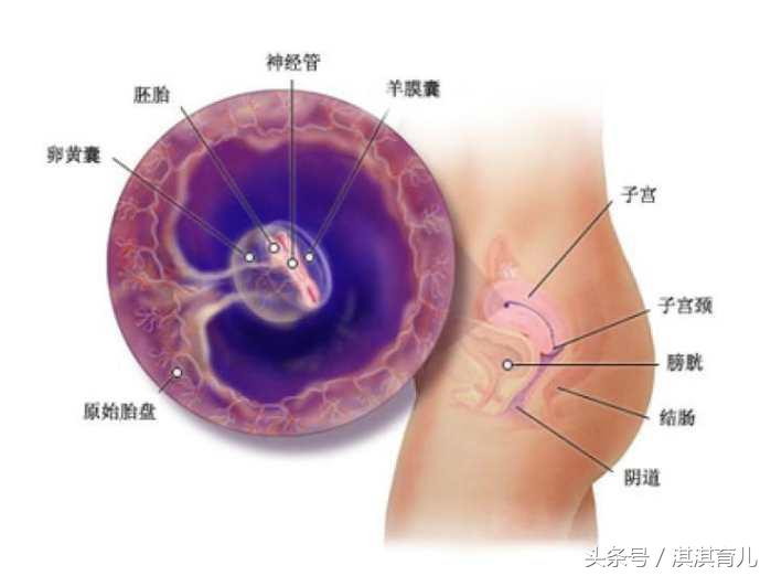 怀孕4周却来“月经”！到底是虚惊一场，还是先兆流产？