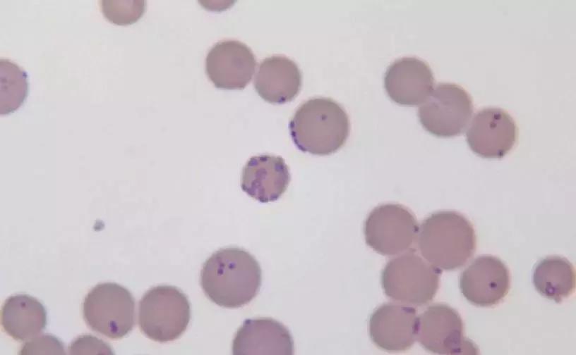 穿好奶奶织的毛裤，你依旧无法避免与风湿膏药共度晚年