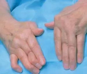 穿好奶奶织的毛裤，你依旧无法避免与风湿膏药共度晚年