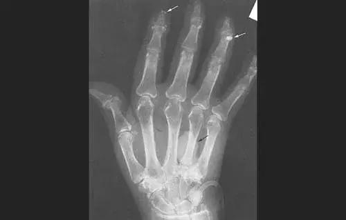 穿好奶奶织的毛裤，你依旧无法避免与风湿膏药共度晚年