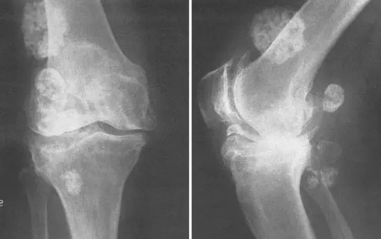 穿好奶奶织的毛裤，你依旧无法避免与风湿膏药共度晚年