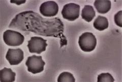 穿好奶奶织的毛裤，你依旧无法避免与风湿膏药共度晚年