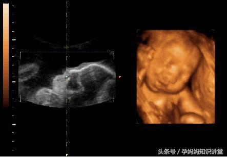 婴儿发育标准对照表0到36个月,怀孕36天宝宝的发育视频