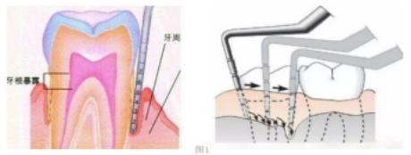 科普牙周小知识,牙周基础知识大全