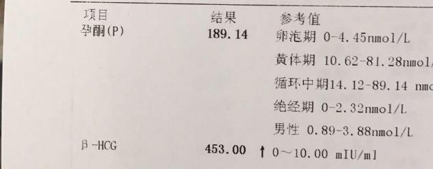 有巧克力囊肿就有子宫内膜异位症,子宫内膜异位症巧克力囊肿致不孕