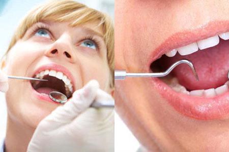 牙根发炎牙齿松动怎么治疗,牙根发炎什么原因导致