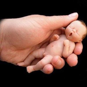 婆婆羊水少怎么办,婆婆羊水少每天多喝水