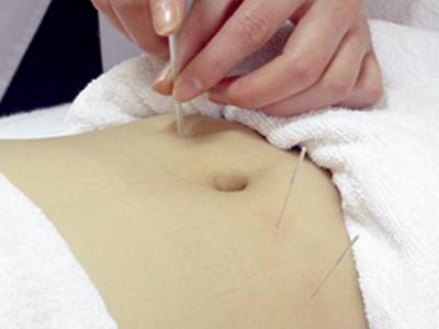 针灸减肥最新技术,针灸减肥最有效的方法