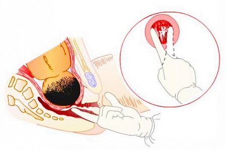 分娩开十指真有那么宽吗,自然分娩时开十指有多大