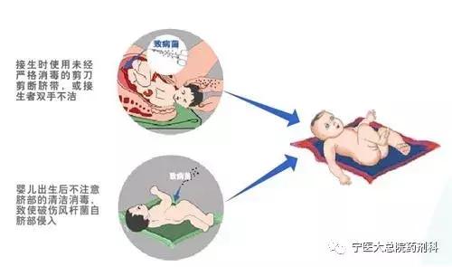 苦笑面容破伤风,破伤风苦笑面容可以治愈吗