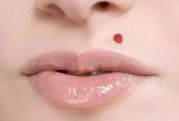 每个人是不是都有痣,每个人都必须有痣吗