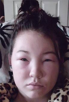 你有脸肿的现象吗？不怕，这里有办法解决！