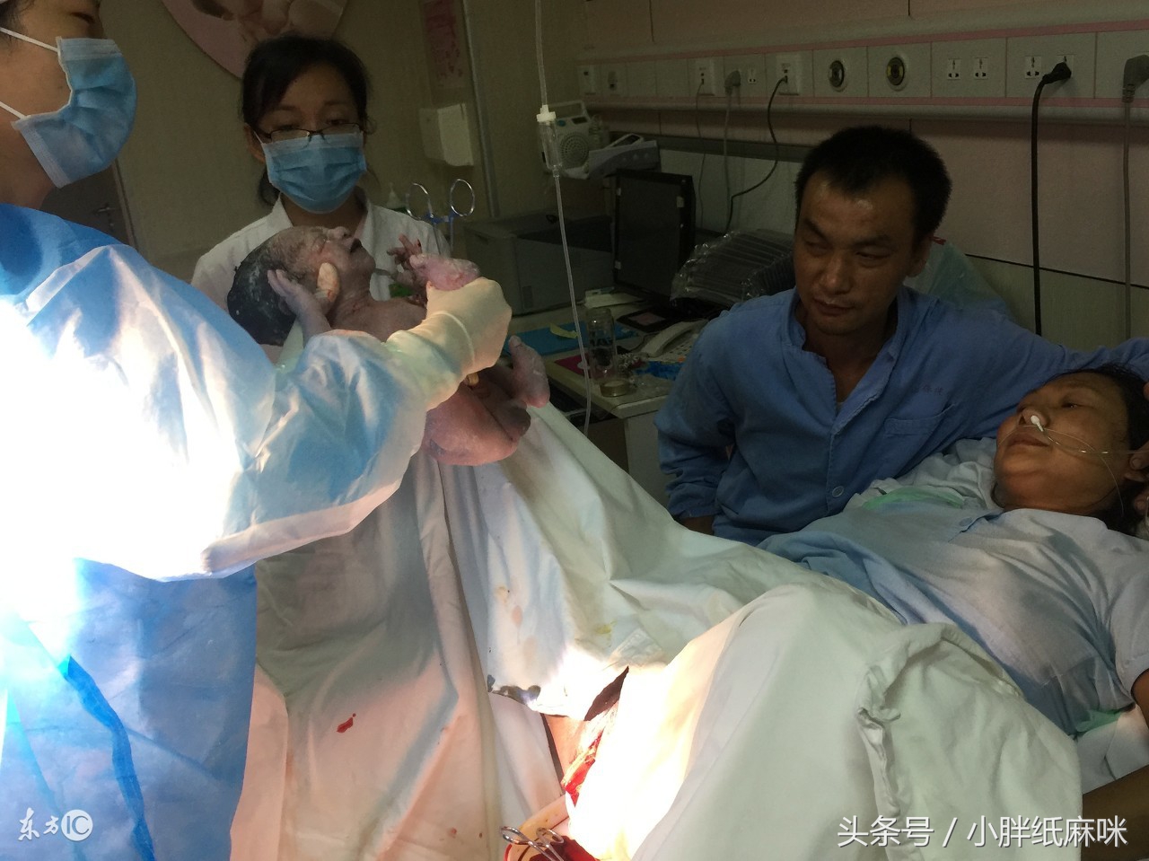 为什么很多顺产都侧切,顺产你得过哪些后遗症