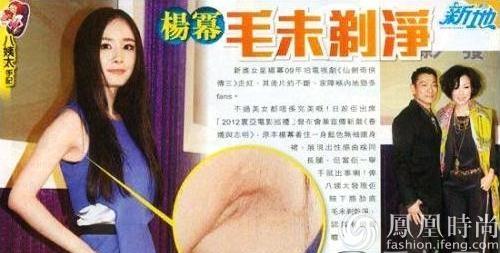 脱毛有什么小方法最好,脱毛的一些注意事项