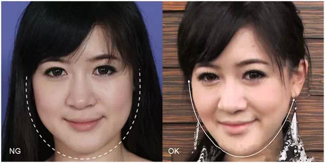 健康科普术后的护理方法,术后养护真的很重要