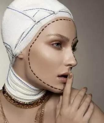 微整形黑幕大曝光,揭秘微整形认知误区