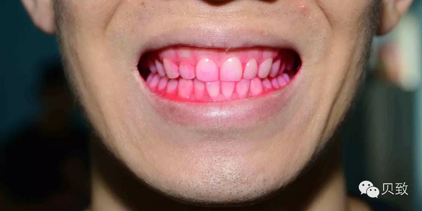 牙博士几款牙膏真实测评,贝医生原力唤醒美白牙膏测评