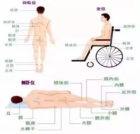 预防压疮最有效的护理措施是,预防压疮的护理湿热敷