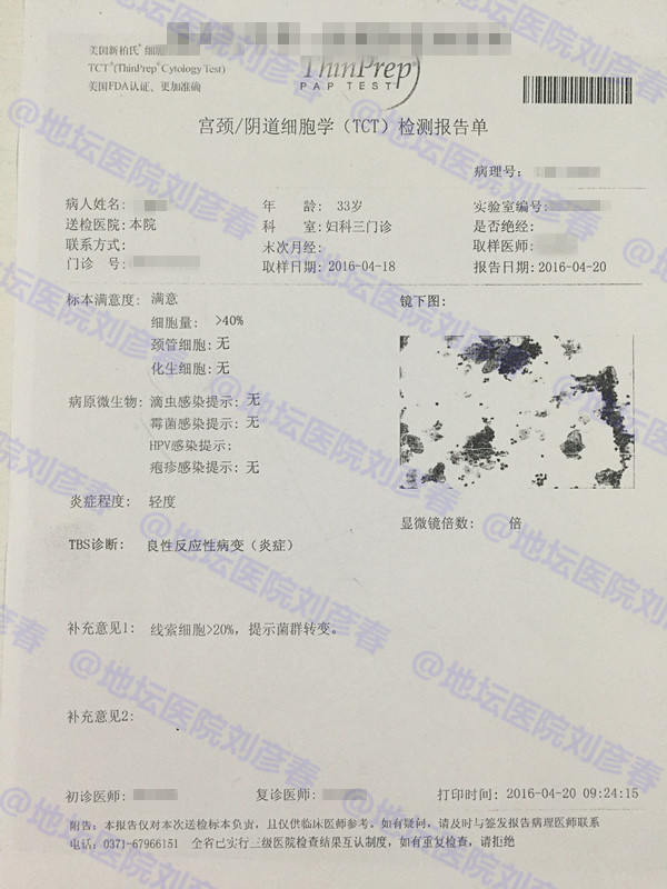 病例分享——宫颈锥切一年后仍有高度病变，该怎么办？