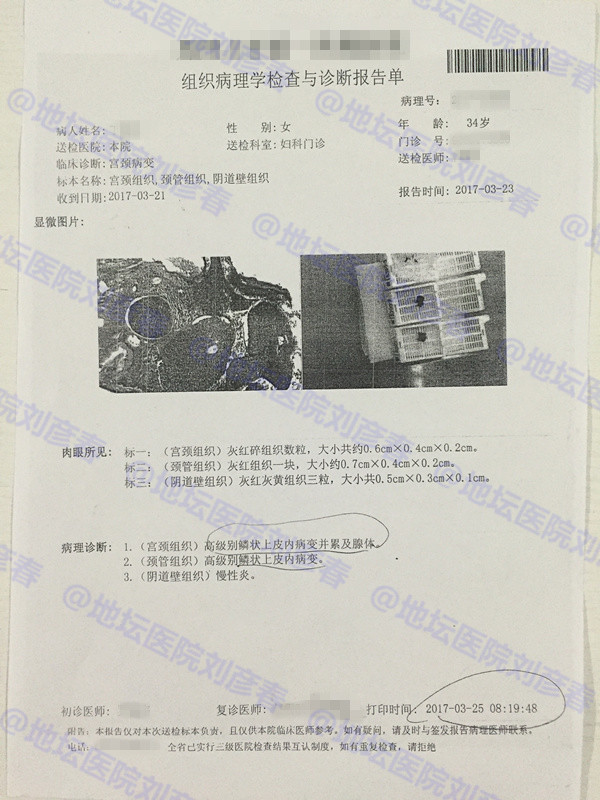 病例分享——宫颈锥切一年后仍有高度病变，该怎么办？