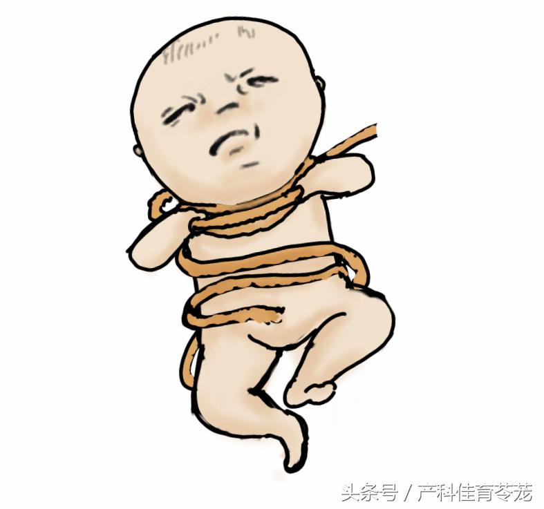 什么胎动需要警惕,胎动真的很重要