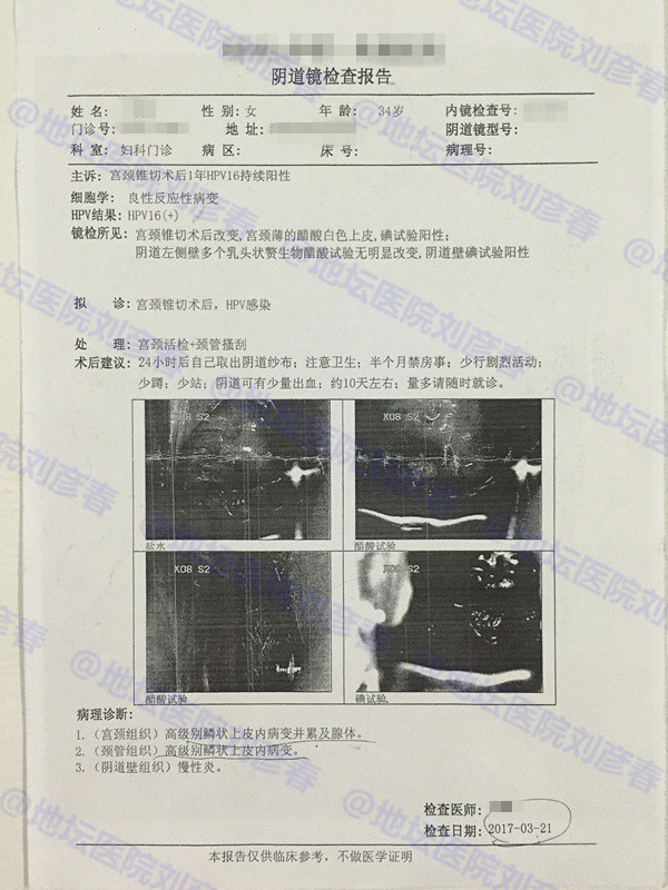 病例分享——宫颈锥切一年后仍有高度病变，该怎么办？