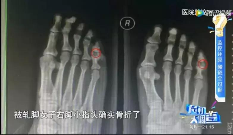 有行车记录仪遇到碰瓷也不怕,开车遇到碰瓷行车记录仪怎么办