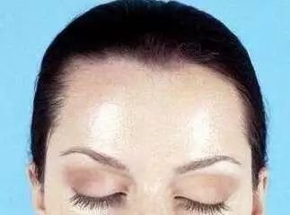 为什么明星不爆痘,熬夜真的会导致爆痘吗