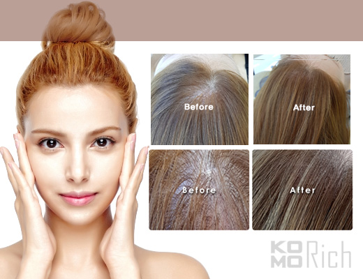 发际线怎么修得更立体一点,发际线不规则怎么修整