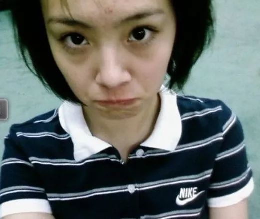 郑爽屏幕前貌美如花，幕后满脸痘花，明星都被坑的痘痘该怎么治？