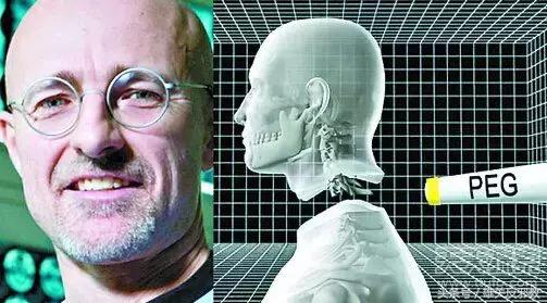 关于换头的看法,如果换头成功了会怎么样