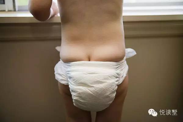 宝宝护臀膏可以擦痱子吗,痱子粉可以去尿布疹吗