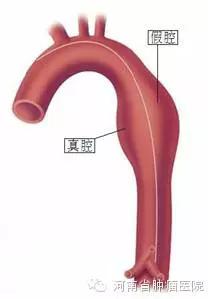 这个病死亡率达到60%，有腹痛时可能就是信号，转发吧