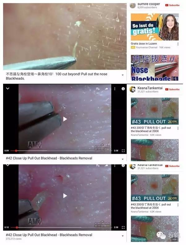 挤黑头过程留一个坑,挤黑头的工具如何使用图解