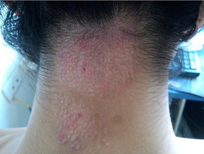 准妈妈应警惕孕期七种痛,准妈妈孕期七大禁忌