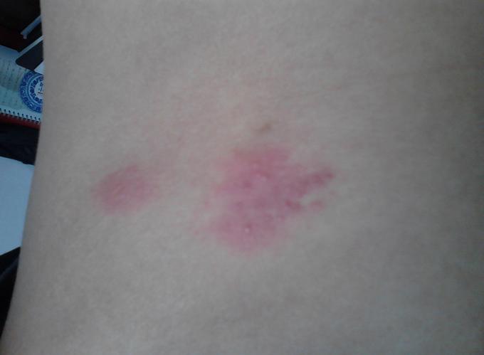 准妈妈应警惕孕期七种痛,准妈妈孕期七大禁忌