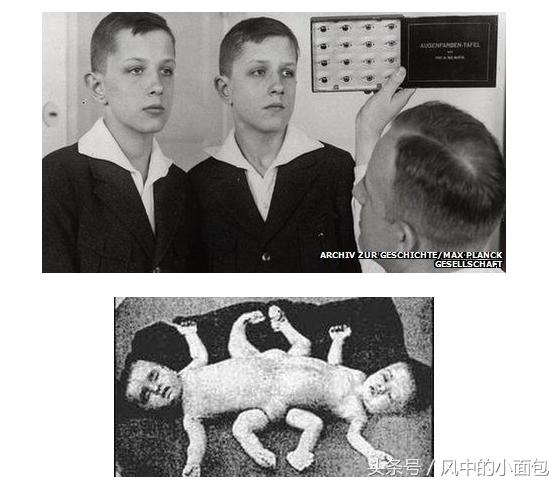 一半是科学，一半是冷血，历史上那些臭名昭著的科学实验