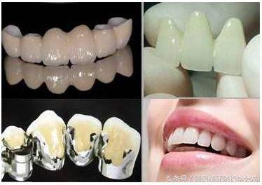 烤瓷牙表面掉瓷了对人身体有害吗,小加工厂做的烤瓷牙对身体有害吗