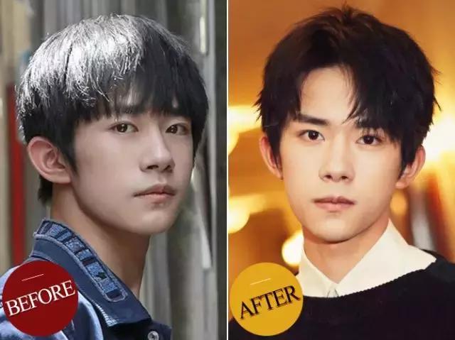 易烊千玺为什么颜值变化这么大,易烊千玺近年来的颜值变化