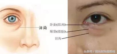 黑眼圈怎么p才自然,没有黑眼圈怎么能p成有黑眼圈呢