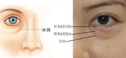 我今年11岁可是有黑眼圈怎么办,十岁女孩一直有黑眼圈怎么治好